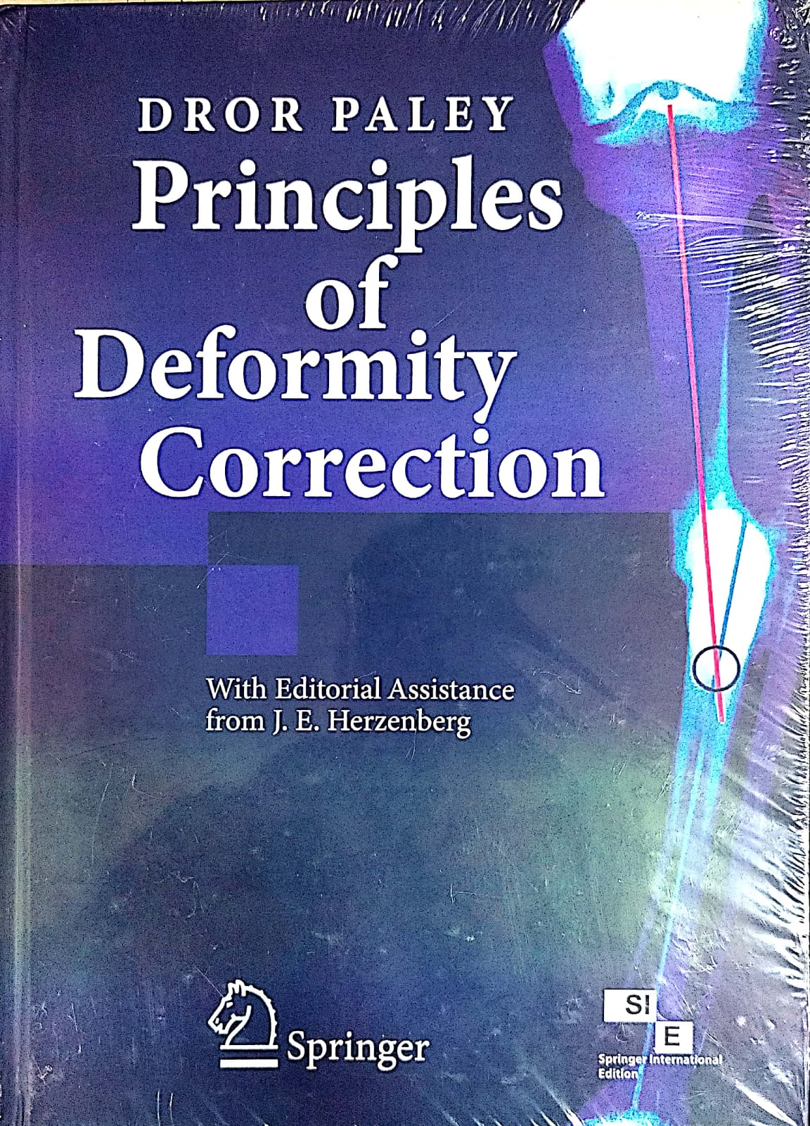 Principles of Deformity Correction SIE/Edn