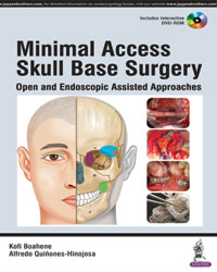 Minimal Access Skull Base Surgery: Open and Endoscopic Assisted
