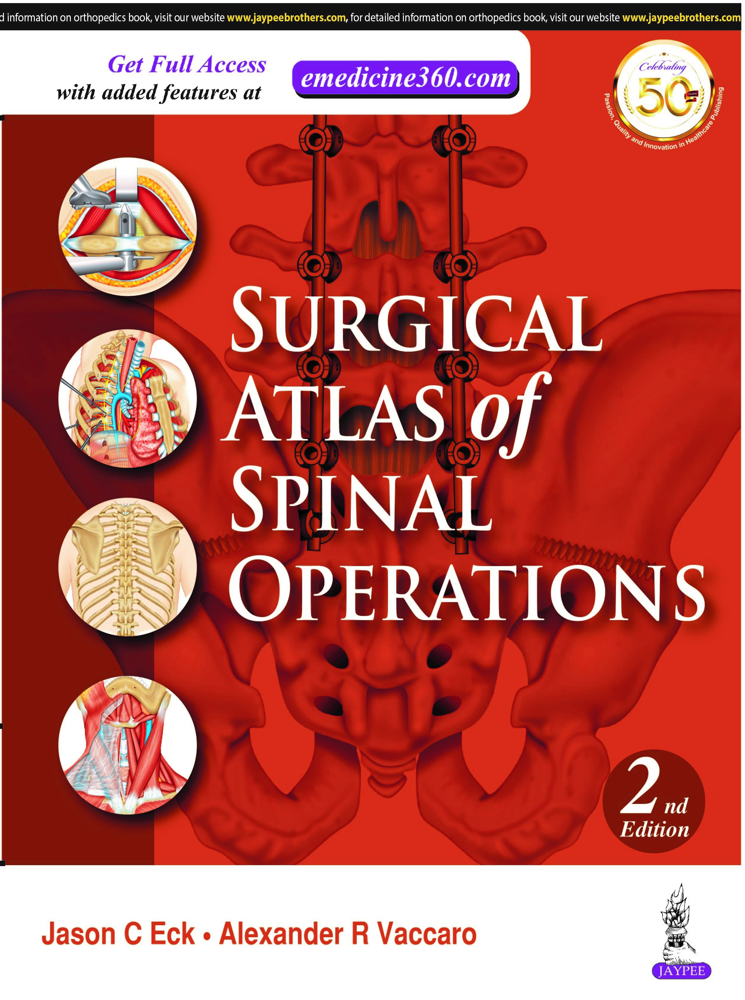 Surgical Atlas of Spinal Operationsfalse